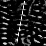 sarcomeres