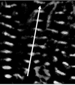 sarcomere structure