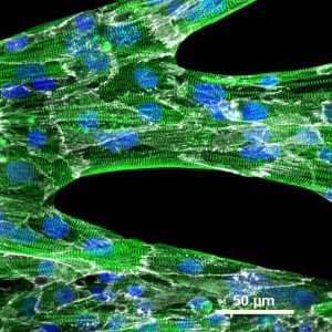 cardiomyocytes cultured in chevron pattern